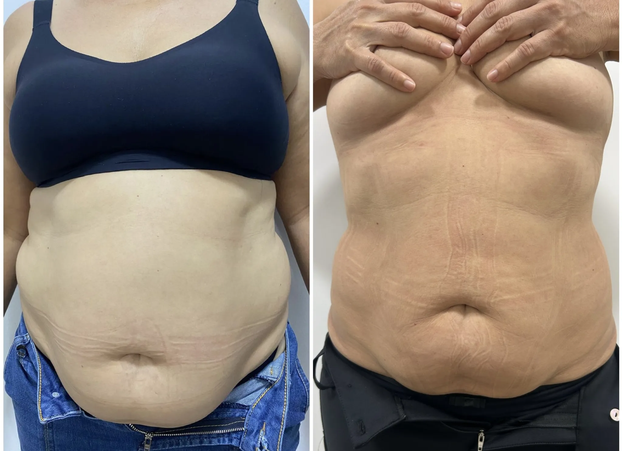 1944A925-58D3-47D6-8B3B-E523D6469D0D-2005-000001B2FA42C951