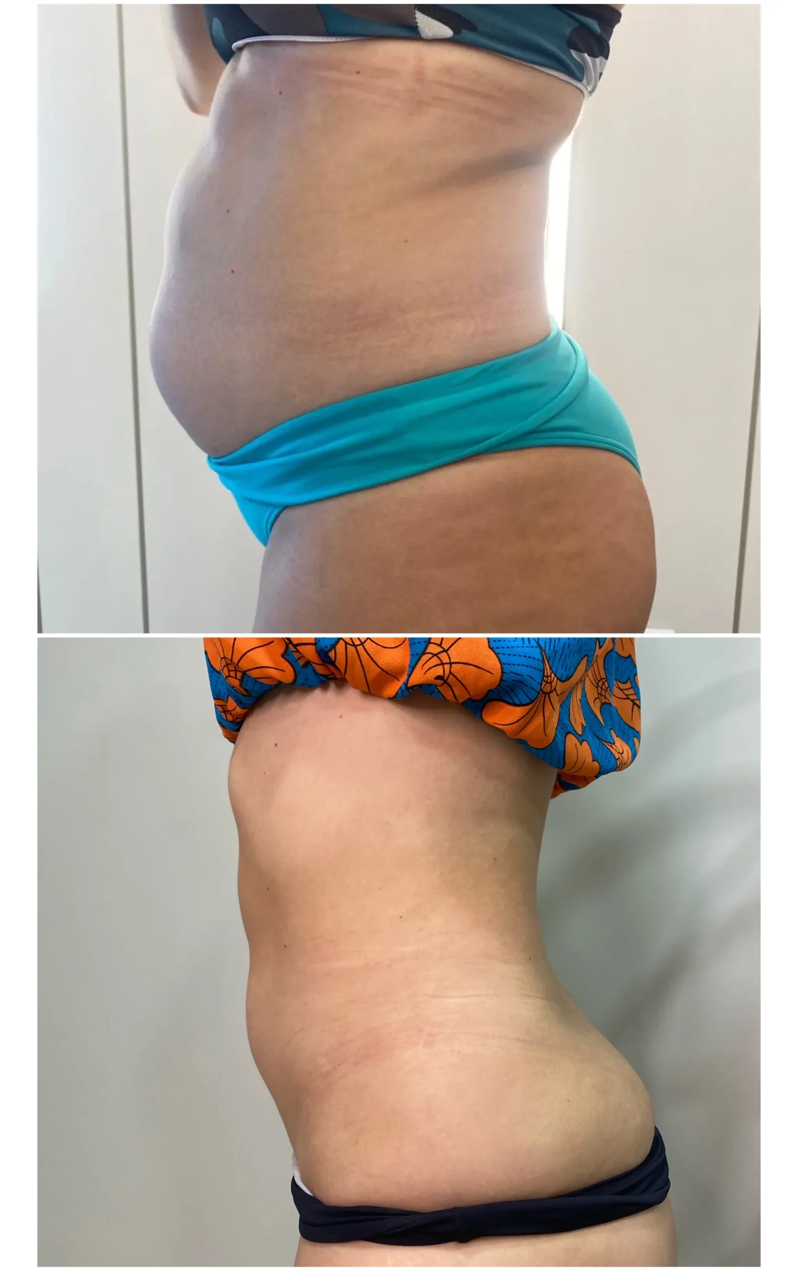 1CDF8B5D-BCCD-4361-8650-433C406B5E29-544-0000003FBBBB6E2B