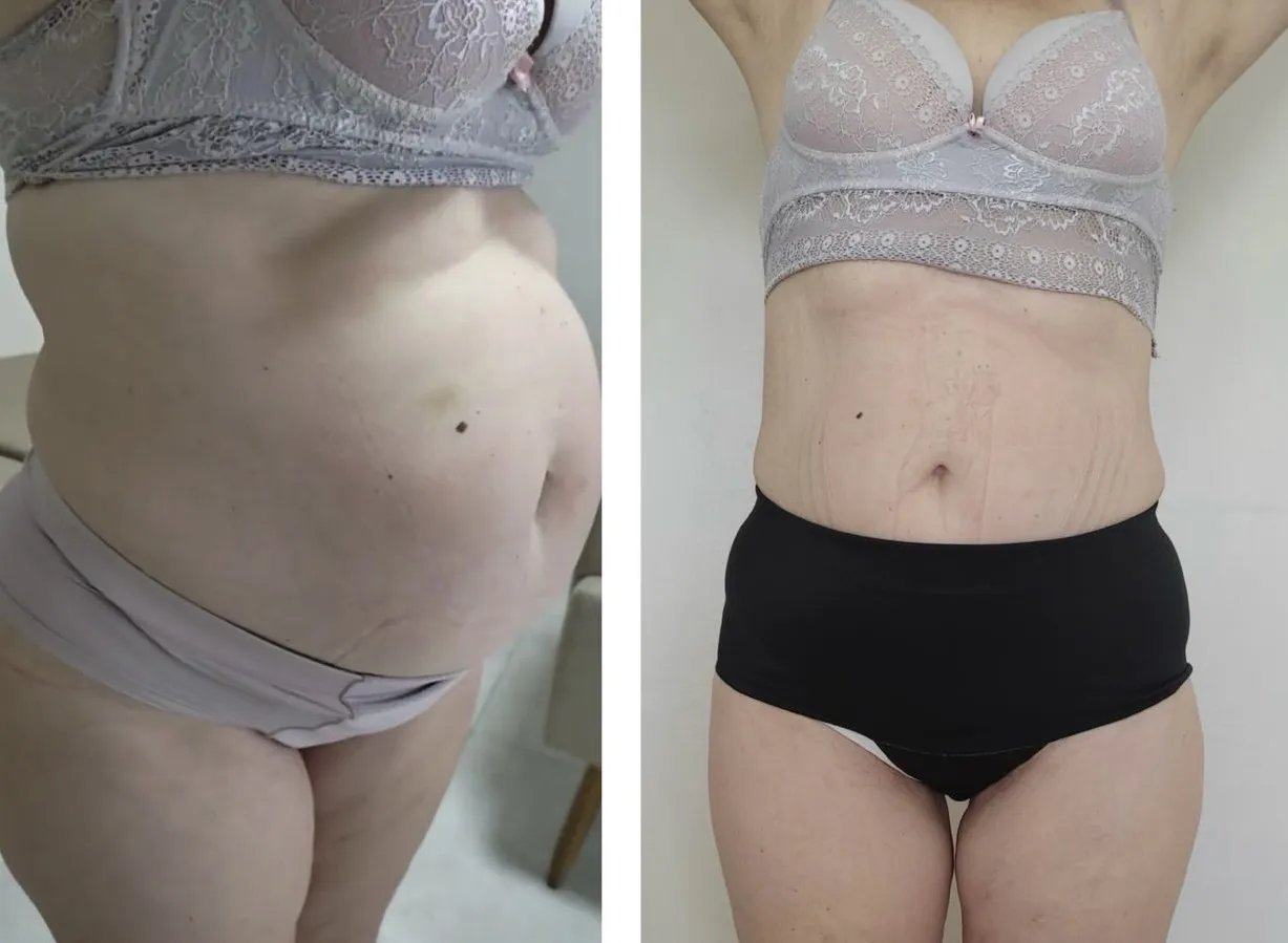 440ba75c-8992-4f9b-a87b-25a574f09d2c